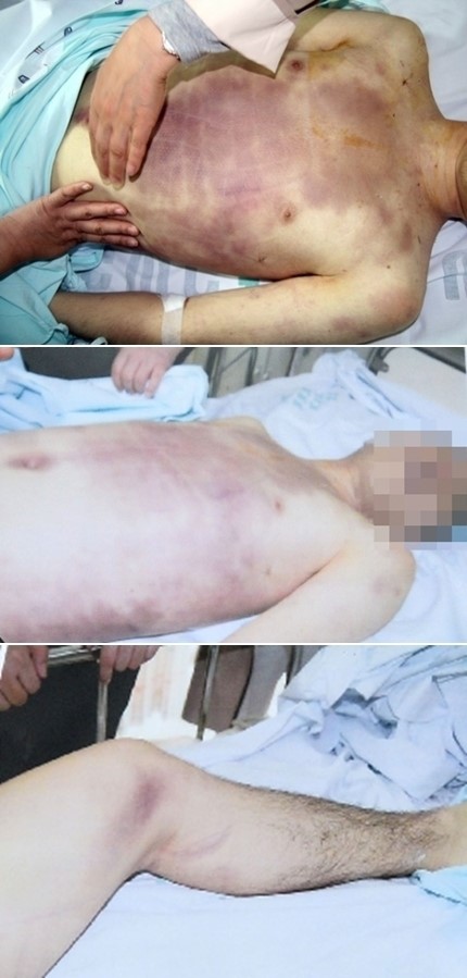 윤일병 사건, 매형·외삼촌이 폭로했다?...국방장관 고의로 사건 은폐하려는 의도는…