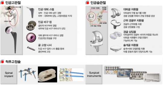 코렌텍 “인공관절 해외 직접 판매 확대”