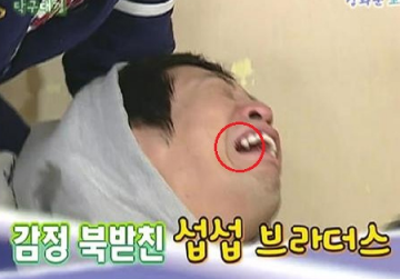 피플크루 멤버 MC몽, 돈 없어서 이빨 치료 못해