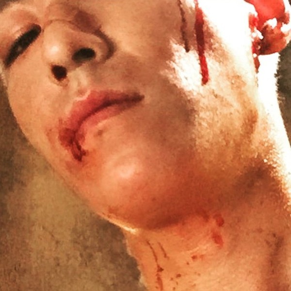 GD&TOP 쩔어 탑 피흘리는 사진 뭐지?