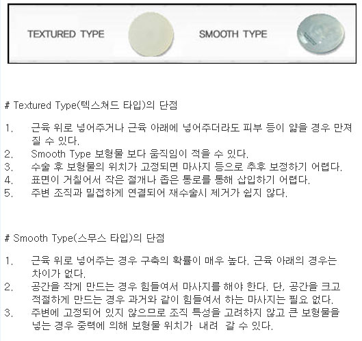 세인성형외과 황세휘 원장, 가슴성형수술 잘알고 하는 것이 중요