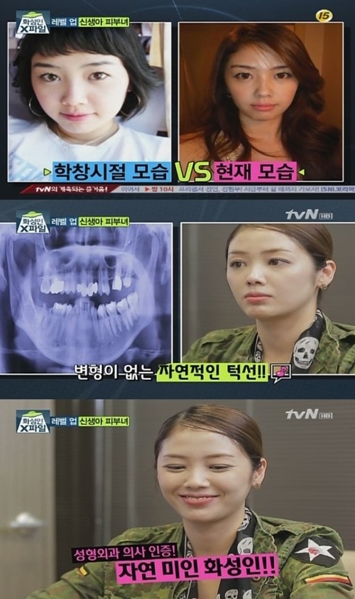 화성인 신생아피부녀 자연미인 입증 “성형안했다” 발끈