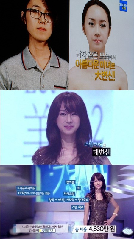렛미인2 최초 트랜스젠더 메이크오버, 4830만원 수술로 러블리 걸 변신