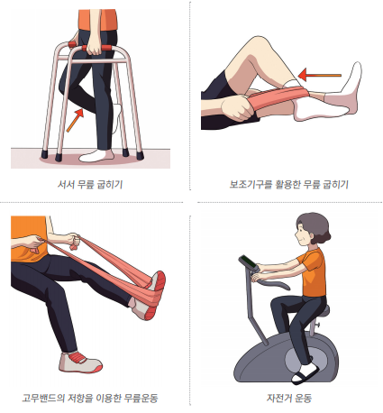 무릎 관절수술 후 재활운동, 어떻게 해야 하나요?