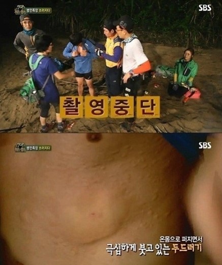 김병만 촬영 중단, 콩가개미에게 물려 붓고 가려움증... 병만족장 쓰러트린 개미? 경악