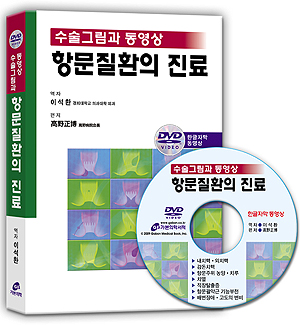 항문질환의 진료