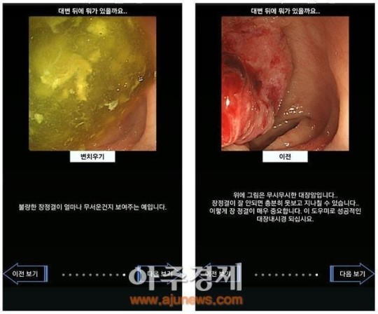 명지병원 대장내시경 장 청소, 스마트폰 어플로 시원~하게