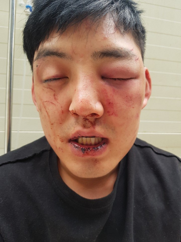 양호석, 차오름 폭행…공개한 사진 보니? 술자리서 쇼하지 말라며 얼굴 발로 차