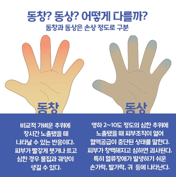 [카드뉴스] 갑자기 추워진 한파! 저체온증과 동창, 동상 대처법