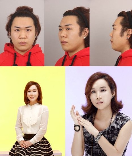 렛미인 김미영, 털 많은 여자에서 청순 미인으로 변신… 놀라운 변화 깜짝