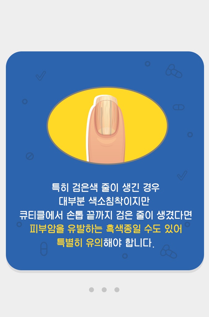 손톱 발톱이 보내는 건강 적신호