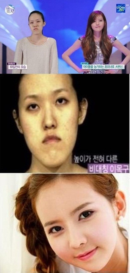 렛미인 심유라 근황, 과거엔 어땠길래 주걱턱 왕따