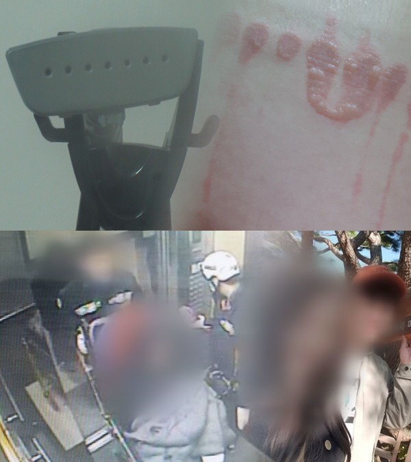 궁금한 이야기y, 먹방BJ 수아씨 데이트 폭력 길체 다리미로 화상까지
