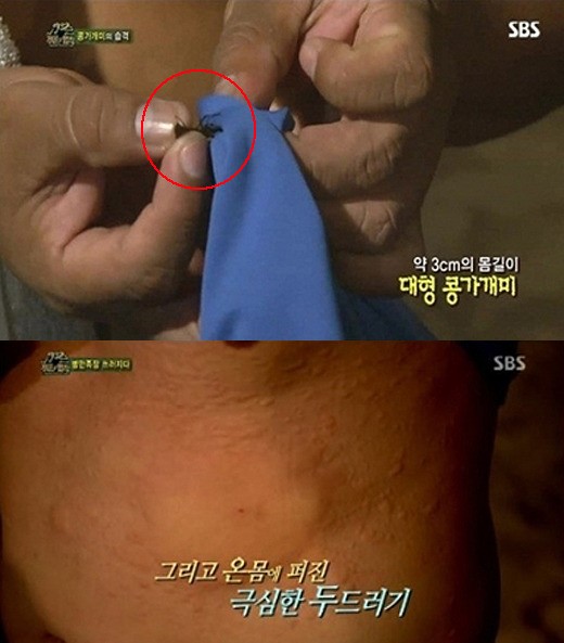 김병만 콩가개미 고통 호소, 긁었더니 온 몸에…경악