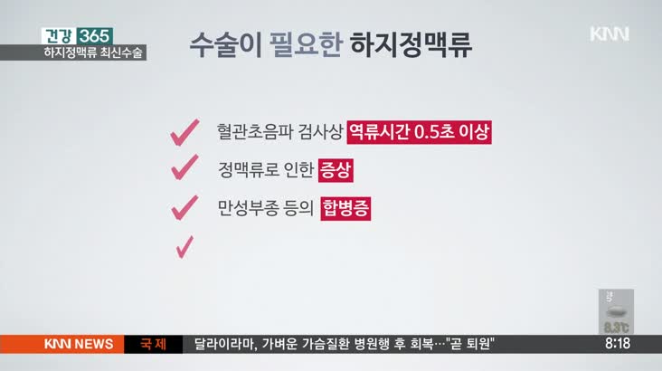 건강365-하지정맥류최신치료