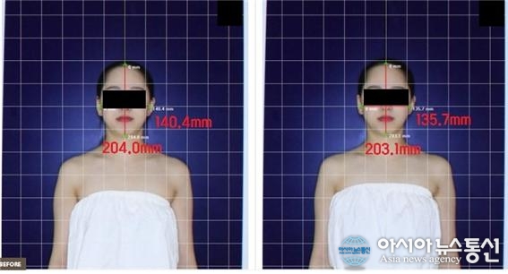 위수영 박사, 얼굴 경락, 26년간 끊임없이 연구합니다