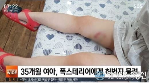 폭스테리어, 아이에게 돌진해 ‘공개된 CCTV 영상’ 보니 충격…입마개도 없이 한두번 아니다?