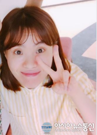 박지선 앓고있던 햇빛알레르기란? 
