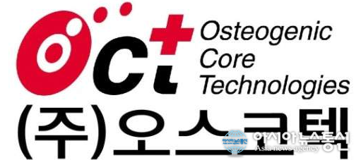 [특징주] 오스코텍 주가 21% 급락세 류마티스관절염 평가지표 충족 못해