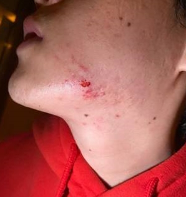 비프리 충격 실체는?... 팬들의 비난 증폭시킨 한 장의 사진 논란의 핫이슈 급부상