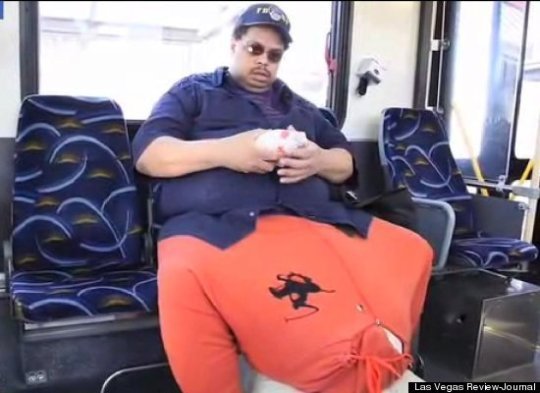 거시기 무게만 45kg  남성, 무료 수술제의 거절