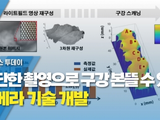 간단한 촬영으로 구강 본뜰 수 있는 카메라 기술 개발