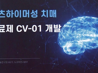 주사 대신 먹는 치매약 나올까...5천억 원 규모 기술수출 계약