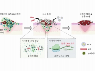 나노입자로 슈퍼박테리아 제거하는 치료법 개발