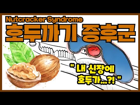 호두까기 증후군? 낯선데 이렇게 흔하다고?