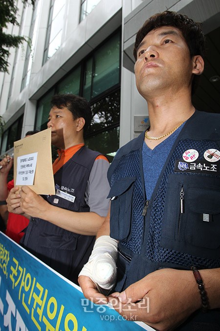 [포토] 경주발레오 사측의 폭력에 손가락을 부상 당한 조합원