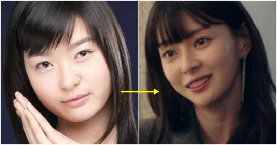 “성형했나?” 미모 하나로 대박 난 여배우, 과거 탈탈 털렸다 (사진 11장)