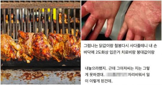 “주인 없기에 직접 통닭 꺼내다가 큰 화상… 치료비 기어코 받아냈습니다” (사진)
