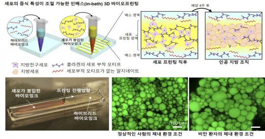 3D 프린팅  ‘지방조직’ 으로 비만 잡을까?