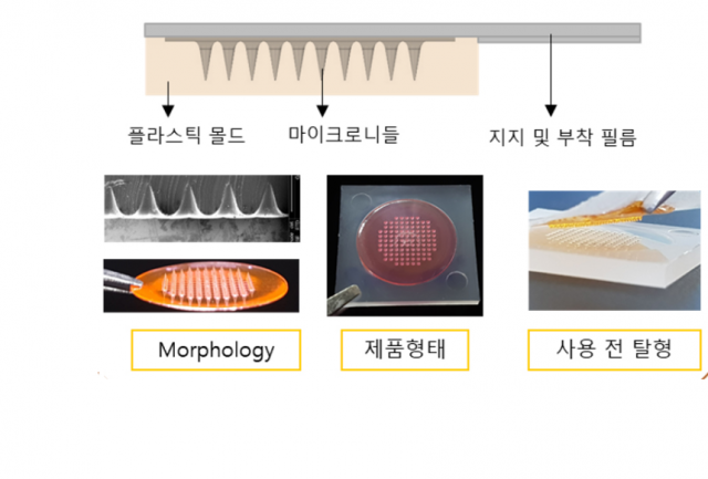 제약·화장품 활용 무궁무진한 마이크로니들 개발 경쟁 뜨겁다