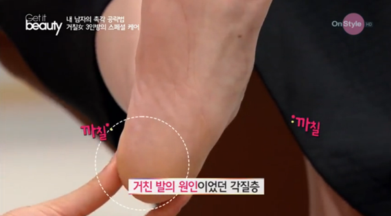 올바른 발 건강관리, 썸남썸녀 확 깨는 순간 발 뒤꿈치 각질…매끈 발 관리법은?