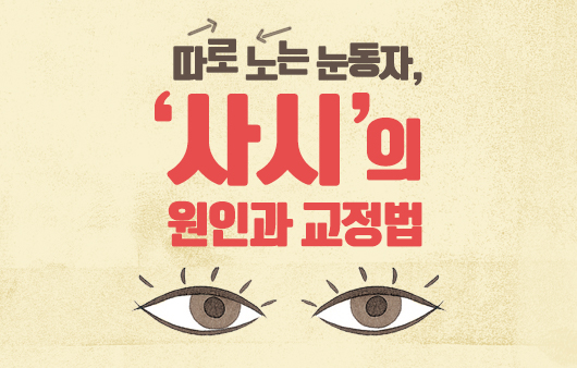 따로 노는 눈동자, ‘사시’의 원인과 교정법