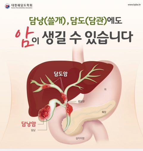담도암과 담낭암