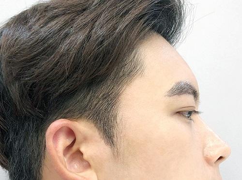 반영구 헤어라인으로 탈모는 물론 얼굴크기와 이미지도 확 달라져