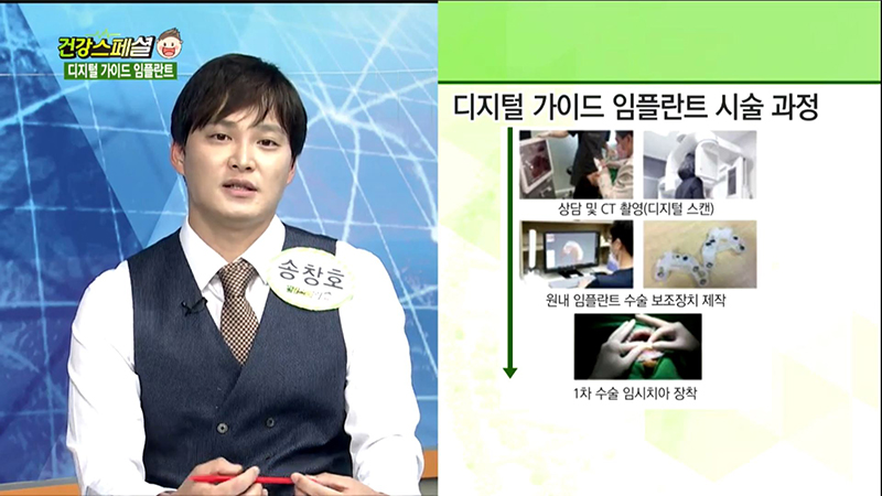 대전서울브라운치과 송창호원장 매일경제TV에 출연