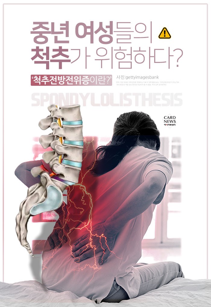 [카드뉴스] 중년 여성들의 척추가 위험하다? ‘척추전방전위증이란?’