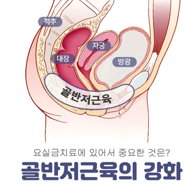 질 성형 수술 · 요실금 치료 환자 증가세