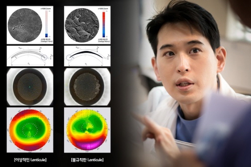 수연세안과 박성배 원장, 한국백내장굴절수술학회 심포지엄서 특별강연