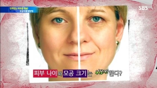 모공 주름 관리해야 동안 피부