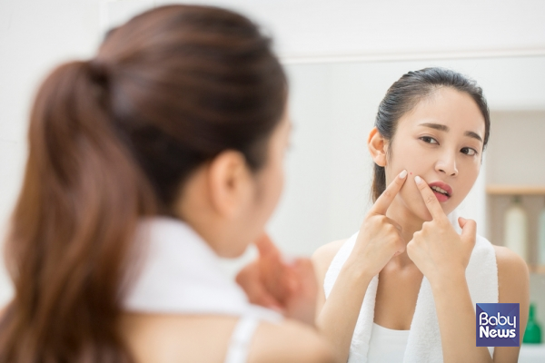 여름철 잔뜩 달아오른 여드름 피부 다스리는 비결은?