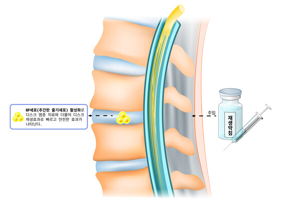 [기고]첨단 줄기세포 활성화 치료법과 전통 한의학의 만남(2)