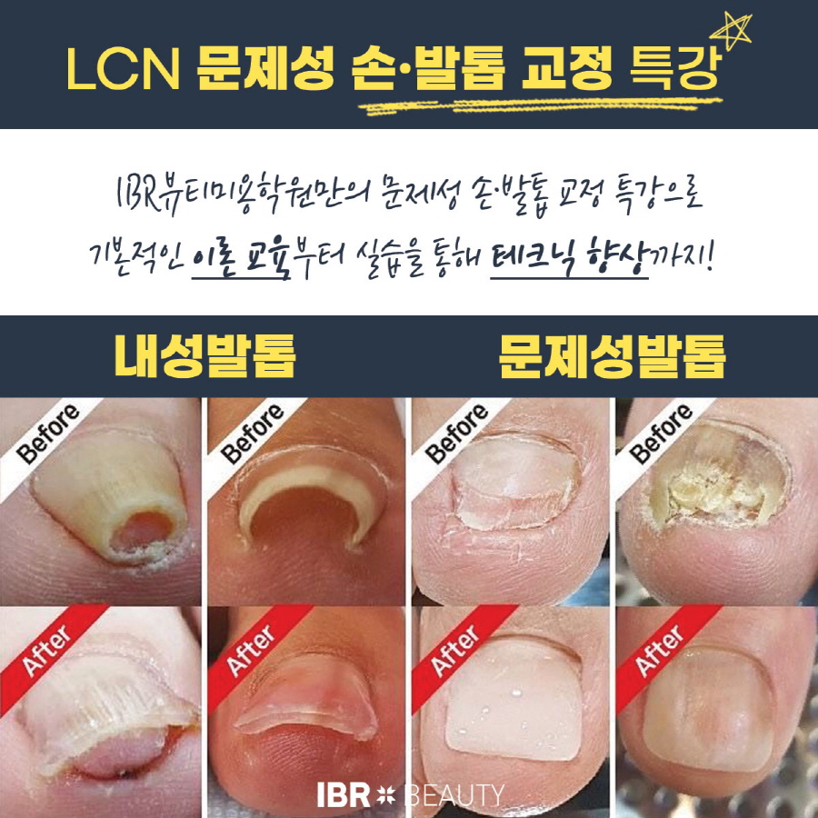 IBR뷰티미용학원, 네일아트 LCN 문제성 손·발톱 교정 특강 진행