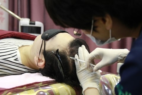 ‘머리카락 많이 빠지면’…탈모 구분법 소개