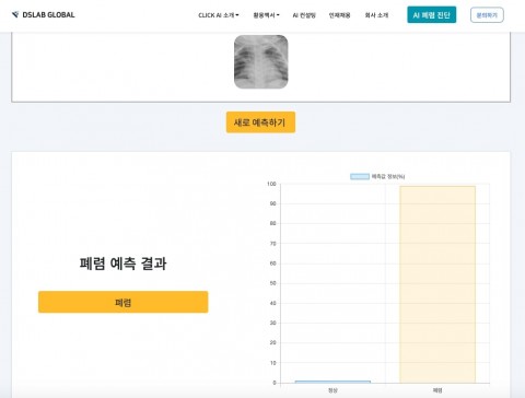 디에스랩글로벌, 코로나19 진단 위한 보조 수단으로 폐렴 AI 진단 서비스 무료 제공