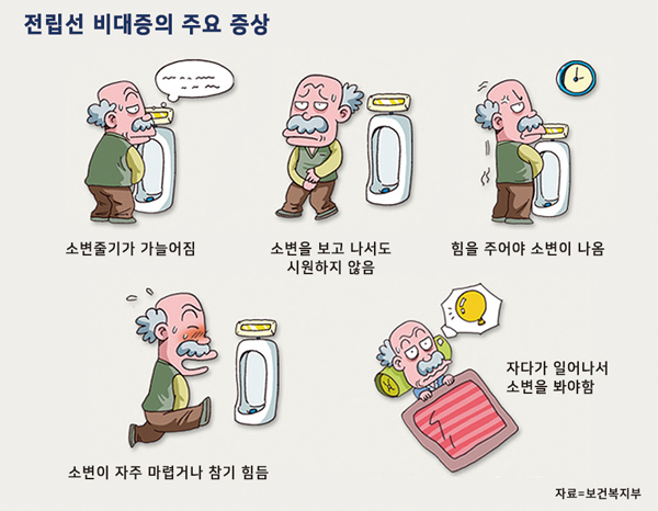 남성의 고민 전립선 비대증… 소변 약해지면 병원 찾아라
