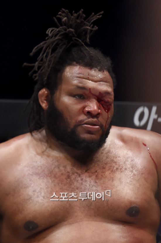 [ST포토]크리스 바넷 눈 쪽 깊은 상처